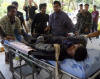 Thai volunteers and paramedics shift a dead body in a hospital in Thailand's restive southern Narathiwat province on September 22, 2008. Suspected separatist rebels shot dead a father and son in Thailand's far south and later decapitated one of the men and left the corpse on a public road. At least 3,400 people have been killed since fresh separatist unrest erupted more than four years ago in the south of Thailand. AFP PHOTO / Madaree TOHLALA. From Getty Images by AFP/Getty Images.