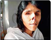 Zahida Perveen, now with empty eye sockets, is totally dependent on family members since her husband tried to kill her.